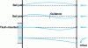 Figure 3 - Various buckling profiles of compressed axles with different connections