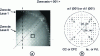 Figure 26 - Microdiffraction pattern for 001 orientation of precipitates