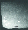 Figure 15 - Example of fine porosity detection in an as-cast sample (microfocus source and X-ray image intensifier).