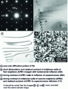 Figure 14 - Visualization of antiphase walls in an ordered Fe3Al-based alloy.