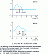 Figure 15 - Transfer function for two microscopes 200 kV and 400 kV with the same CS ≥ 1.2 mm