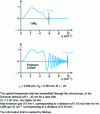 Figure 16 - Comparison of the transfer functions of the same microscope with a LaB6 gun and a thermally assisted field emission gun (Schottky diode).