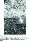 Figure 6 - Illustration of the use of the bright and dark field technique