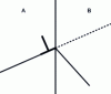 Figure 31 - Blocking dislocations at a grain boundary