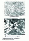 Figure 35 - Nucleation of ferrite lamellae on titanium oxide particles 