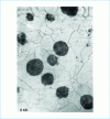 Figure 1 - Graphite spherulites in a fully ferritic spheroidal graphite cast iron by annealing. Etched sample