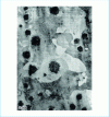 Figure 2 - Spheroidal graphite cast iron with a pearlitic matrix, but in which the graphite is surrounded by ferrite, giving a bull's-eye structure. Attacked sample