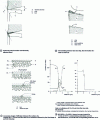 Figure 46 - Degradation of a carbide cutting tool in contact with steel during machining