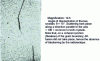 Figure 5 - Autoradiography of an austenitic steel bicrystal (Cr = 16%, Ni = 14%) after diffusion of iron 59 at 1050°C for 7 h, and abrasion of 30  from the deposit.