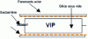 Figure 35 - Steel/VIP/steel sandwich diagram