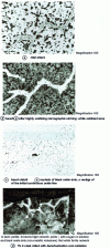 Figure 42 - Hot-worked mild steel with internal oxidation