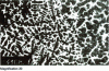 Figure 3 - Equiaxial and globular dentrites (after Eminger )