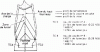 Figure 16 - Effect of off-center loading [20]