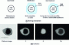 Figure 18 - Formation of lime aluminate inclusions coated with mixed (Ca-Mn)S sulfide in Si-Ca heat-treated aluminum steel