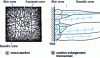 Figure 26 - Solidification structure of continuous casting products