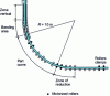 Figure 24 - Example of hard reducer position on a blooms machine [54]