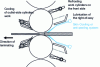 Figure 6 - Right-of-way and cylinder cooling, right-of-way lubrication from Denilson [76]