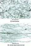 Figure 24 - Attacking the austenitic joints of the previous structure