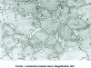 Figure 26 - Plastic replica under light microscopy