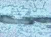 Figure 43 - Focusing on workpiece surface-Nital4-× 500