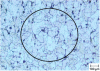 Figure 17 - C10-Nital 4 (light microscopy)