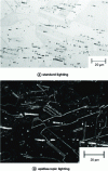 Figure 21 - Macles in austenitic stainless steel, oxalic acid (optical microscopy)