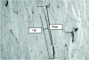 Figure 34 - C10 hardened (optical microscopy), Nital 4