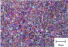 Figure 36 - Spheroidal graphite cast iron, Nital4 (optical microscopy)