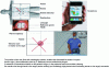 Figure 17 - Perform a puncture-biopsy procedure, using a tablet or smartphone to control the collimation of the needle towards its target.