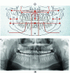 Figure 15 - (a) Criteria for a successful dental panoramic. 1c: coincides with the median sagittal plane. 2a: images of right and left ascending branches have the same dimensions. Condylar axis 1a is perpendicular to 1c. The maxillary tooth apices project on average below the sinus floor. (b) Example of a panoramic image showing all maxillofacial structures.
