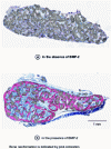 Figure 6 - Histological images of a biomaterial implanted at 2 months in an ectopic site