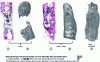 Figure 9 - Histological section and 3D X-ray microtomography of a metatarsal bone defect 6 months after bone substitute implantation