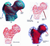 Figure 4 - Correction of a femoral head mesh: (a), (b) EF atlas mesh (blue) and points on the patient surface (red); (c) calculation of the T transformation; (d) application of T to all nodes of the atlas mesh: generation of the 3D EF patient mesh (in red) (Photo credits: Laboratoire TIMC-IMAG)