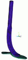 Figure 11 - ANSYS (ANSYS Inc, USA) software representation of a finite element model of an energy-restoring prosthetic foot.