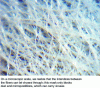 Figure 6 - Optical microscope photograph of a non-woven respiratory mask fabric