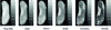 Figure 9 - Infrared thermography of the foot in contact with various materials after 1 minute [38].