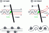 Figure 57 - Influence of pitch on fabric morphology. Upper diagrams: profile view (weft thread section) of the stitch-weft-front-stitch zone. Lower diagrams: fabric warp thread cross-section.