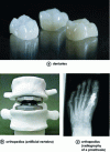 Figure 25 - Examples of biomedical glass-ceramics applications