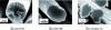 Figure 20 - SEM photograph (LCTS) of characteristic cross-sections of carbon fibers