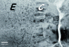 Figure 25 - TEM observation of the microstructure of an LSCF deposit (after [19])