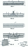 Figure 1 - Schematics of the ceramic composite armor concept patented in 1963 by Richard Cook (Goodyear Aerospace Corporation). The concept involves an alumina ceramic supported by a fiberglass plate. A flexible adhesive is used as a coating and also at the alumina/fiberglass interface [11].