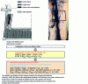 Figure 15 - Brittle layer formation mechanisms in blast furnace crucibles