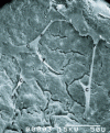 Figure 13 - Scanning electron microscopy image showing human mesenchymal stem cells (C) spread out (long filipodia (F)) on the surface of a nanocrystalline apatite deposit overlying a macroporous HA/TCP biphasic ceramic (after [67]; scale bar: 50 μm)