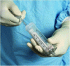 Figure 1 - Preparation of a CPC (mixing phase) using a bi-compartment syringe (Graftys®)