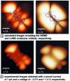 Figure 3 - STM images of a methylterrylene molecule adsorbed onto a thin wire of NaCl deposited on a copper surface (from 15)