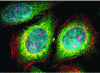 Figure 9 - Fluorescence microscopy images of human epithelial cells, labeled with five different QD colors (in false color) – a protein (Ki-67) appears in pink, actin filaments in red, mitochondria in yellow, microtubules in green and the nucleus in blue [86]