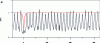 Figure 12 - Second-order correlation function g(2) for pulsed (black) and continuous (gray) excitation. The dip at zero delay is characteristic of single-photon emission (time delay). (from [12])