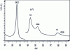 Figure 5 - Crude X-ray diffraction pattern (Cu Kα 1.54 Å) of a smooth laminar-type pyrocarbon. Peaks 002, 004, 006 and asymmetric bands 10 and 11 are shown.