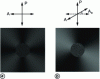 Figure 3 - Evolution of the light intensity reflected by a concentric pyrocarbon under polarized and analyzed light, as the analyzer rotates from 0° to 180° with respect to the polarizer. a) When the polarizer and analyzer are crossed, there is a "Maltese cross" pattern. b) At the angle of extinction, the two branches of the cross merge, and the intensity is zero along a direction close to 45°.