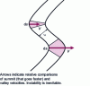 Figure 10 - If two successive steps become modulated (the steps descend from left to right), the peaks have a larger facial area (to their right, i.e. towards the lower terraces) and will therefore collect more atoms than the valleys.